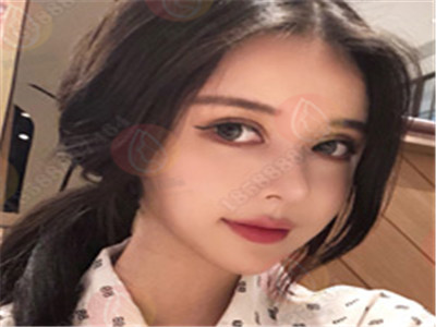 广州网红整形案例